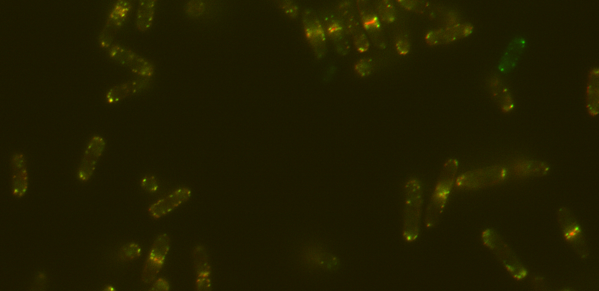 Combined image above shows the data. Majority of protein signal co-localises (yellow), with red only seen on cytokinetic ring. However due to lack of bleed through this system gives the researcher 100% confidence that the colocalisation is real.